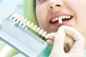 dental_img007
